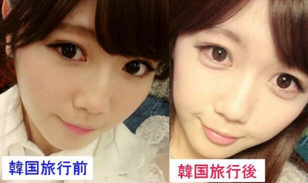 mihomiyazakibolsitas